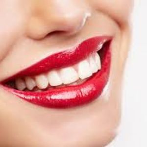 Meet your Posher, Charlie